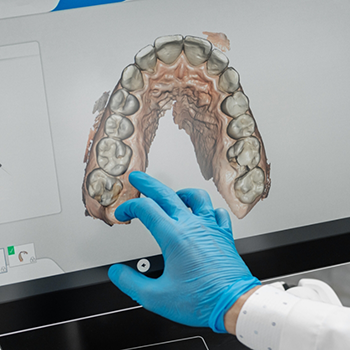 Dentist taking a look at digital scan of teeth on monitor