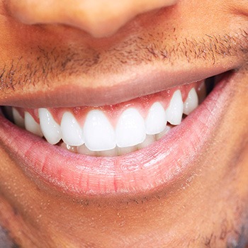 Closeup of a man’s smile