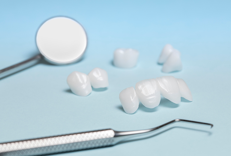 Multiple veneers lying next to dental instruments