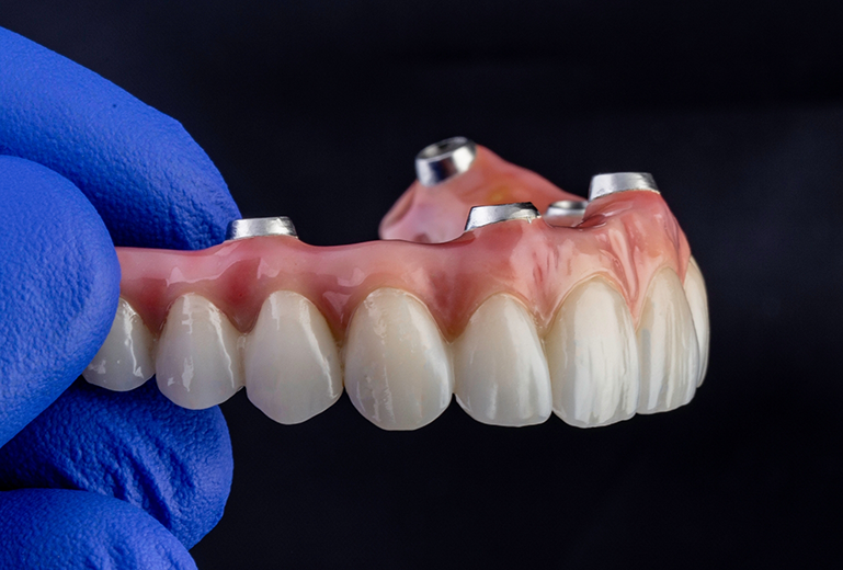 Close up of gloved hand holding denture
