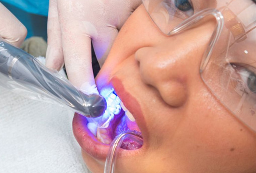 Dental during light being used to harden tooth-colored filling