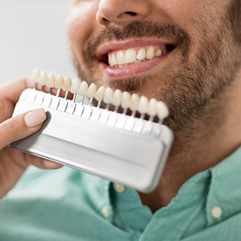 a 3D illustration of a veneer covering a tooth