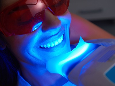 Professional teeth whitening costs more than over the counter whitening but the results are worth the price